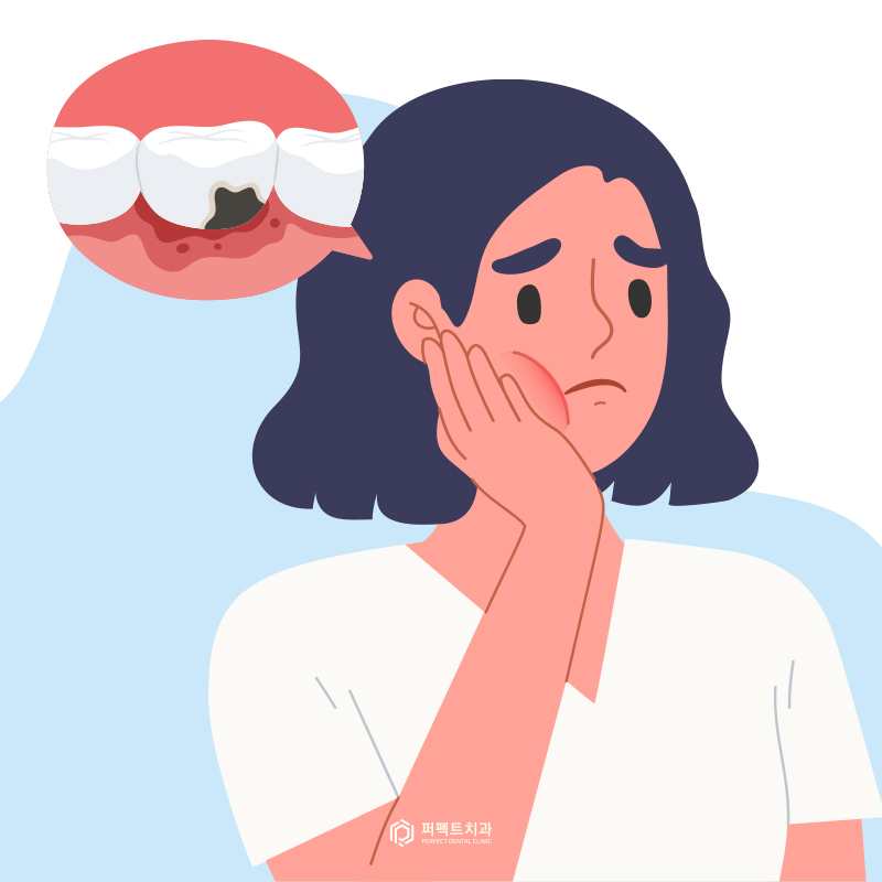 임플란트 상실로 이어질 수 있는 주위염 예방하세요! 관련 이미지 3