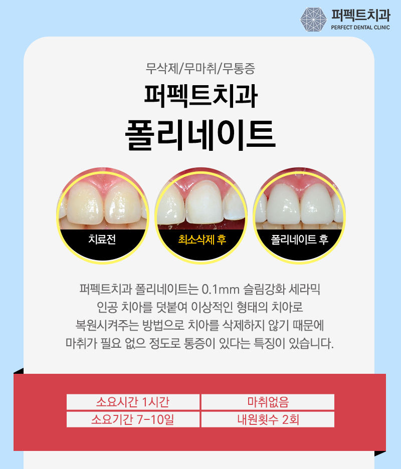 앞니 라미네이트 치아삭제량 확인해보세요! 관련 이미지 2