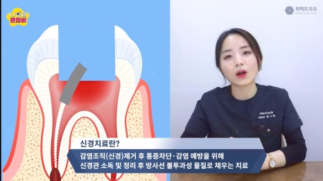 신경치료 후 통증과 주의사항 관련 이미지 2