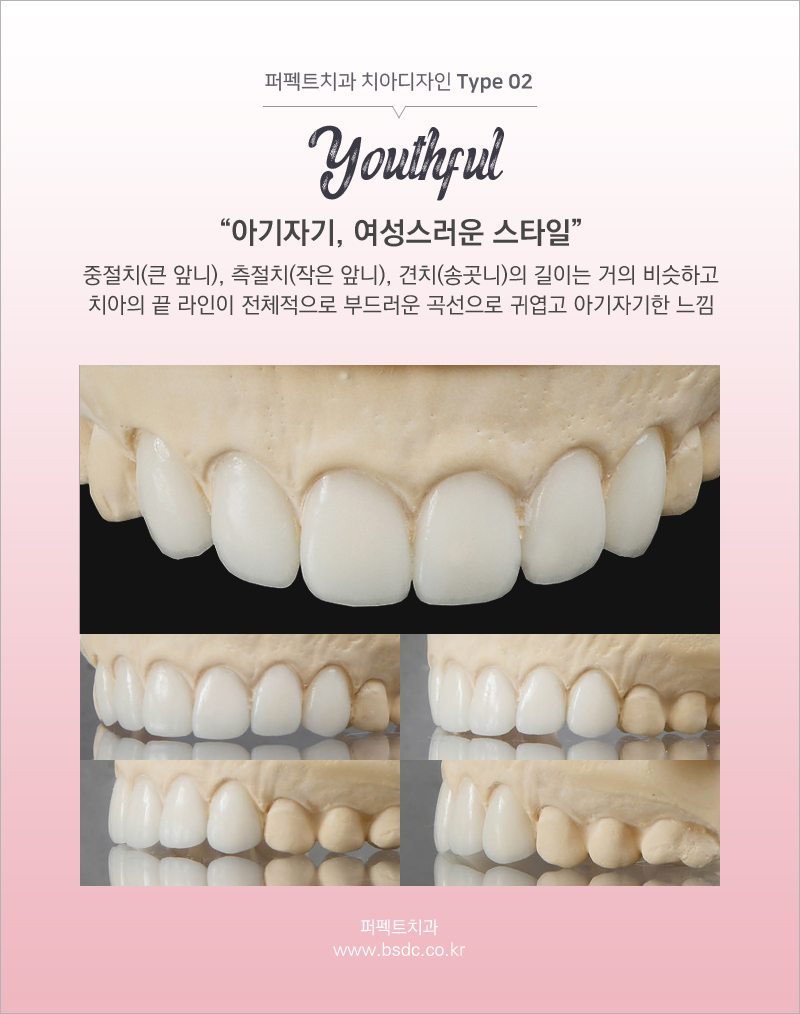 앞니성형 믿고 할 수 있는 치과! 관련 이미지 5