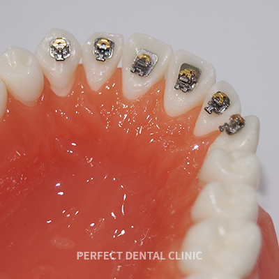 콤비교정에 대해 궁금해요 관련 이미지 10