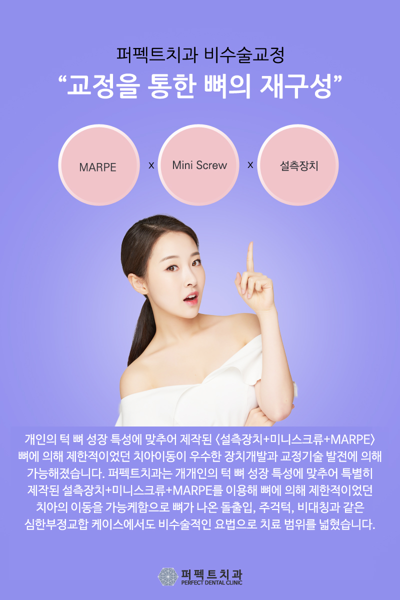 덧니부분교정 후기 좋은 치과 관련 이미지 4