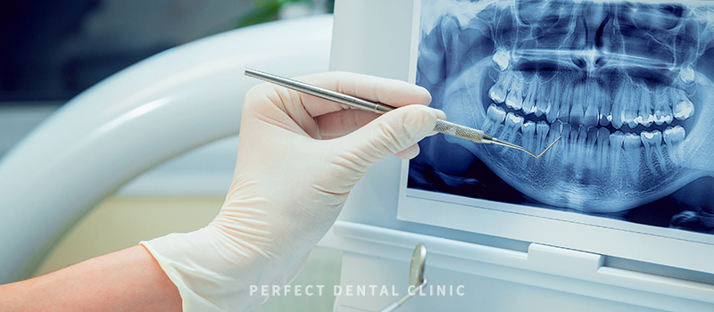 잇몸염증 증상과 좋은 음식 관련 이미지 4