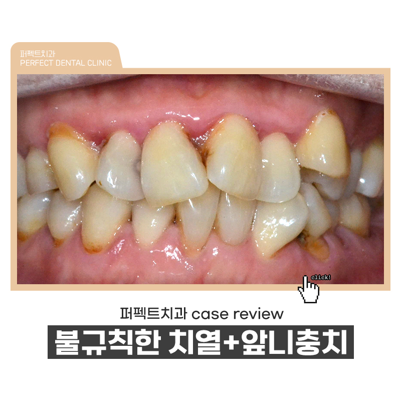 복합적인 치료가 필요한 케이스 리뷰 관련 이미지 1