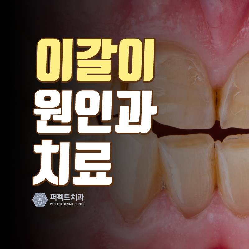 이갈이 원인과 치료방법!! 관련 이미지 1