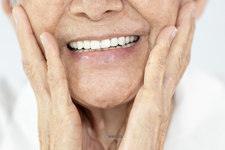 #3탄_의료보험 적용되는 치과치료는?(임플란트편) 관련 이미지 2