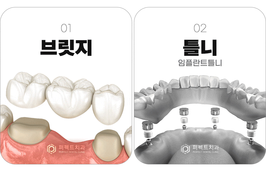 컴퓨터 분석을 통한 임플란트 관련 이미지 3