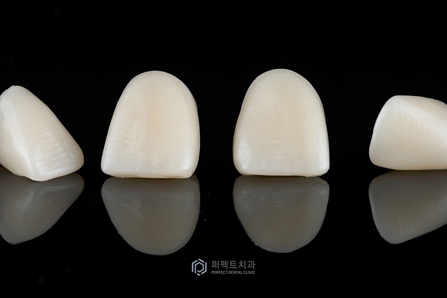 임시치아부터 라미네이트까지✨ 주의사항 알아보기 관련 이미지 2