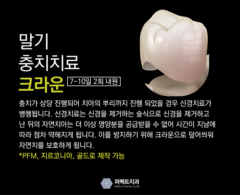 충치치료가격 관련 이미지 6