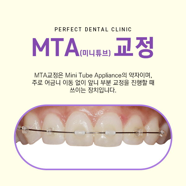앞니 부분교정 비용 관련 이미지 3