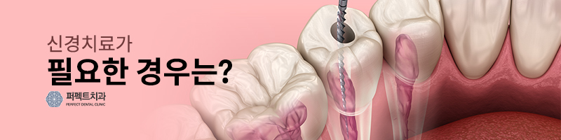 신경치료가 필요한 경우 / 통증,과정,크라운 관련 이미지 2