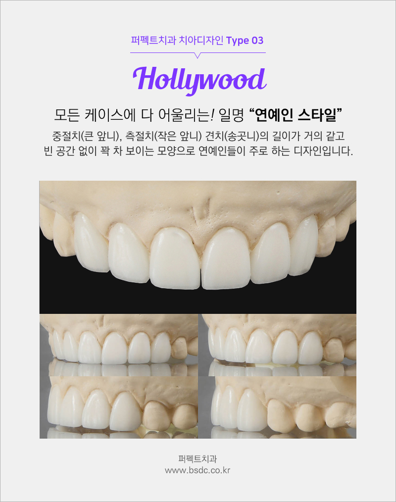 2018년도 마지막 저렴한 라미네이트가격!! 관련 이미지 8