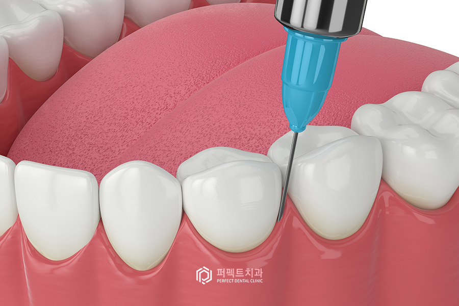 치과 마취①|바르는 마취제, 뿌리는 마취제 관련 이미지 5