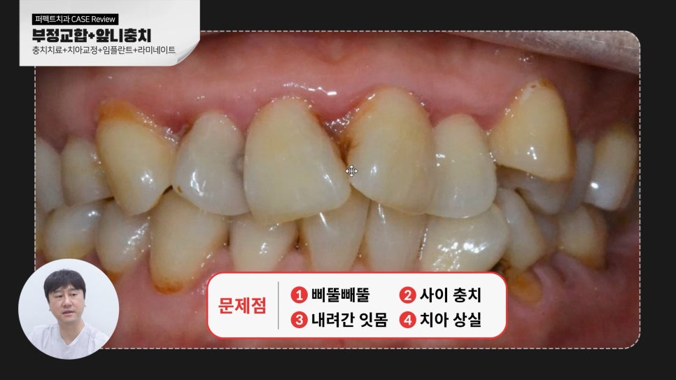 복합적인 치료가 필요한 케이스 리뷰 관련 이미지 2
