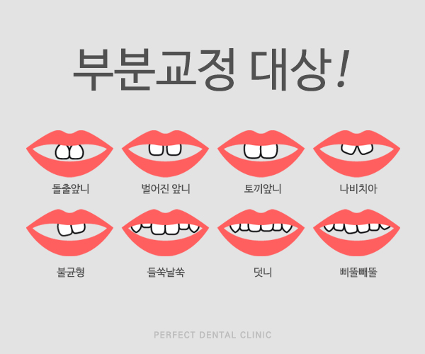 부분교정 찾는 사람들은 주목! 관련 이미지 1