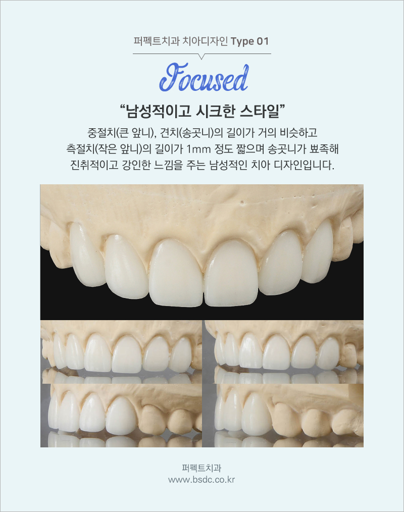 강남 최소삭제라미네이트 알아주는 치과 관련 이미지 8