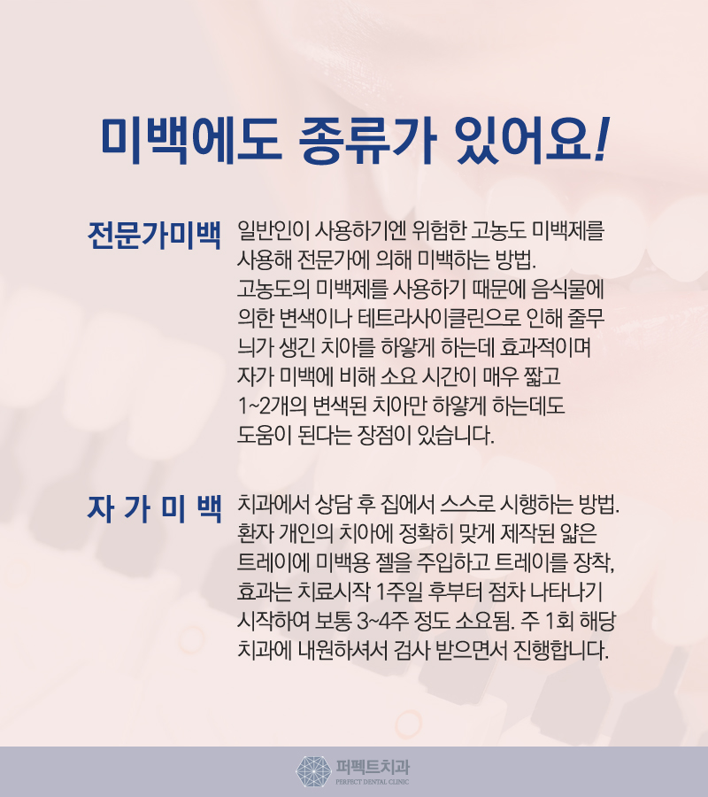 누런이 치아미백으로 탈출하자! 관련 이미지 4