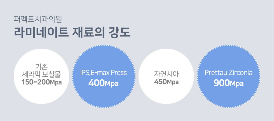 라미네이트 치료 시 참고사항은? 관련 이미지 7