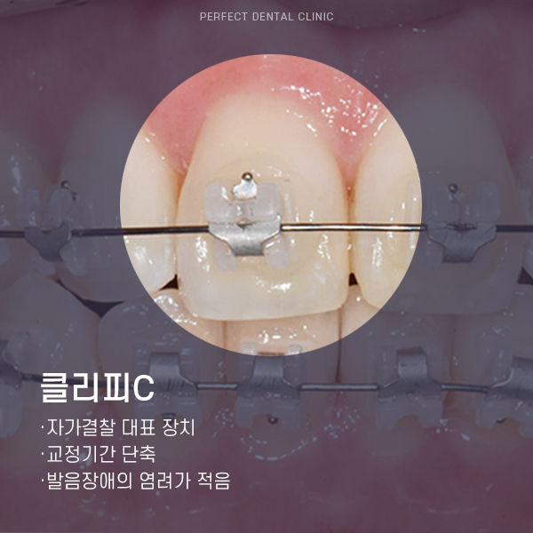 부분교정 찾는 사람들은 주목! 관련 이미지 5
