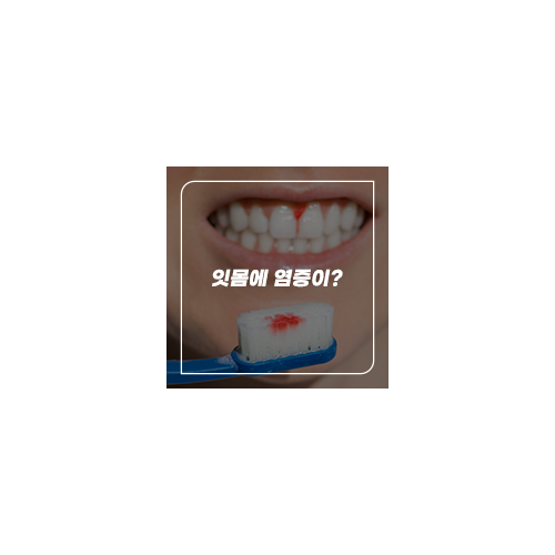 잇몸에 염증 종류와 치과치료 관련 이미지 5