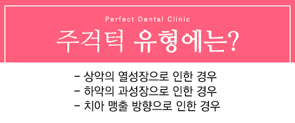 주걱턱치아교정 치아교정만으로 해결가능? 관련 이미지 4