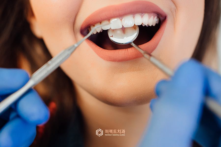 충치치료 후 치아가 시려요!(레진&인레이 치료 후) 관련 이미지 1