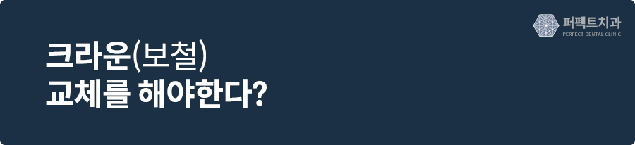 치아에 씌운 크라운 보철, 이런 경우 크라운교체가 필요하다! 관련 이미지 5