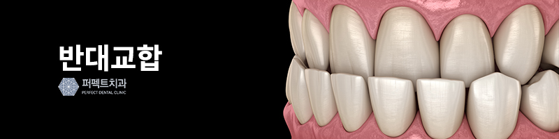 반대교합 비수술 교정 결과는? 관련 이미지 2