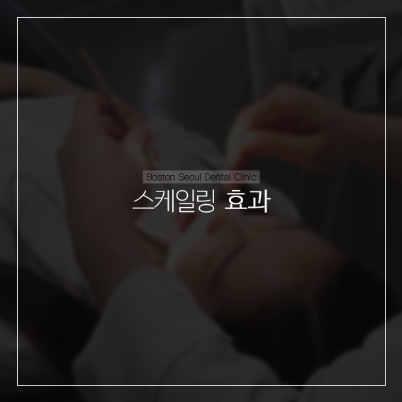 스케일링의 긍정적인 효과들 관련 이미지 1