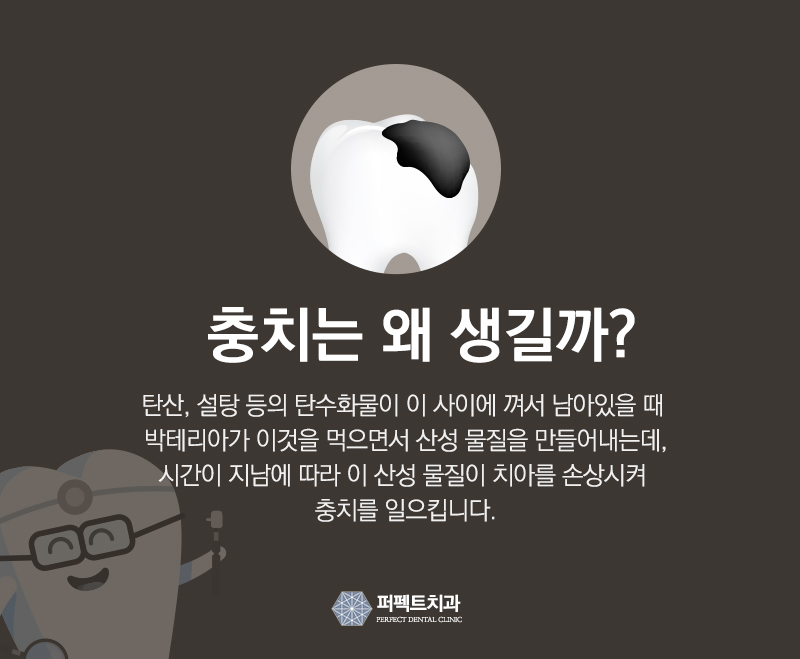 레진필링으로 벌어진 치아 메꾸자 관련 이미지 6