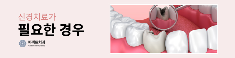 신경치료 아프지 않을까? 관련 이미지 3
