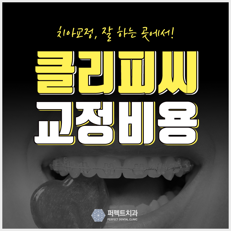 치아교정 클리피씨 교정으로 치료! 관련 이미지 1