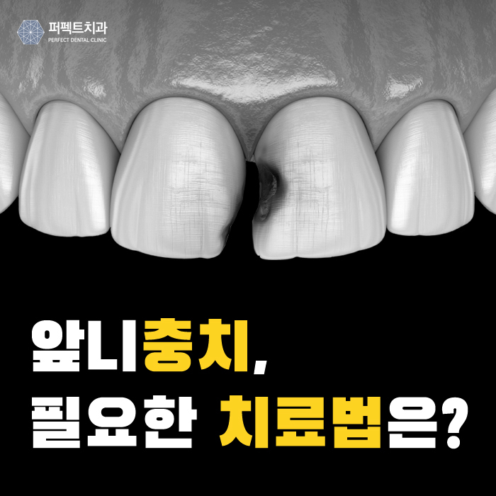 앞니충치, 어떤 치료를 받아야할까? 관련 이미지 1