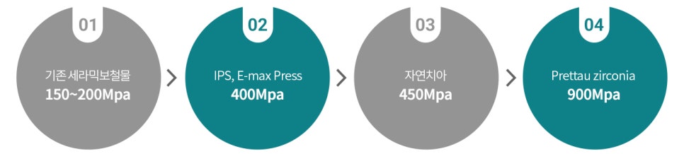 무삭제 라미네이트 리얼 후기 관련 이미지 2