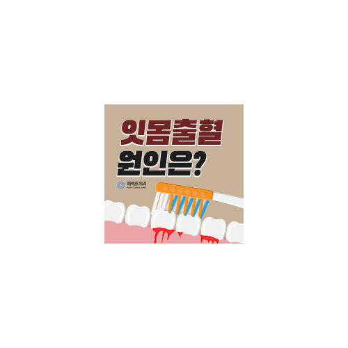 잇몸 출혈 원인 알아보자! 관련 이미지 7