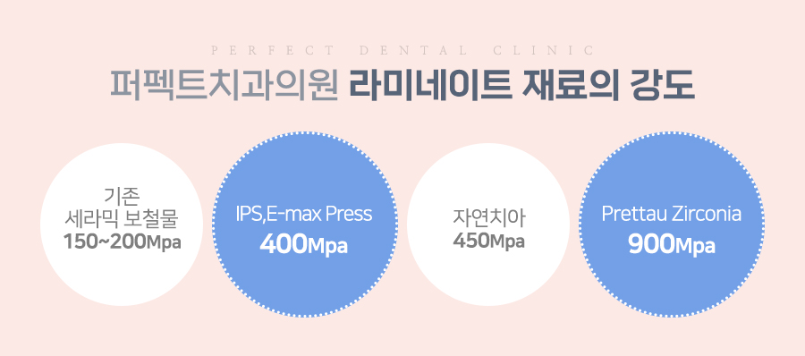 라미네이트 치료 시 참고사항은? 관련 이미지 7