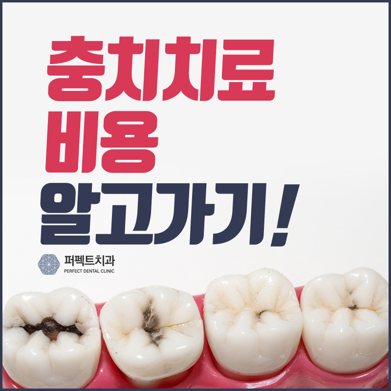 충치치료비용 알고 가자! 관련 이미지 1