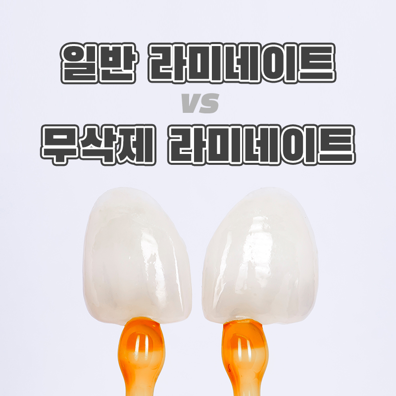 일반 라미네이트 vs 무삭제 라미네이트, 어떤 차이점이? 관련 이미지 1