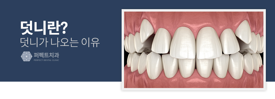 덧니, 교정이 필요하다? 덧니교정의 모든 것! 관련 이미지 2