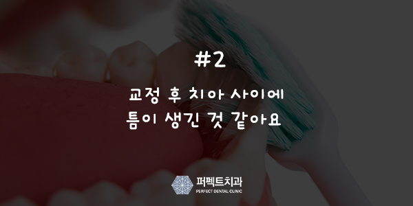 치아교정 후 관리는? 관련 이미지 3