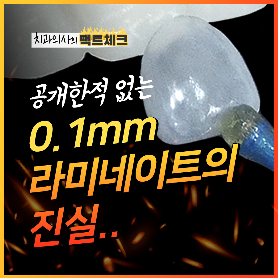 강남 무삭제라미네이트의 진실을 파해치다. 관련 이미지 1