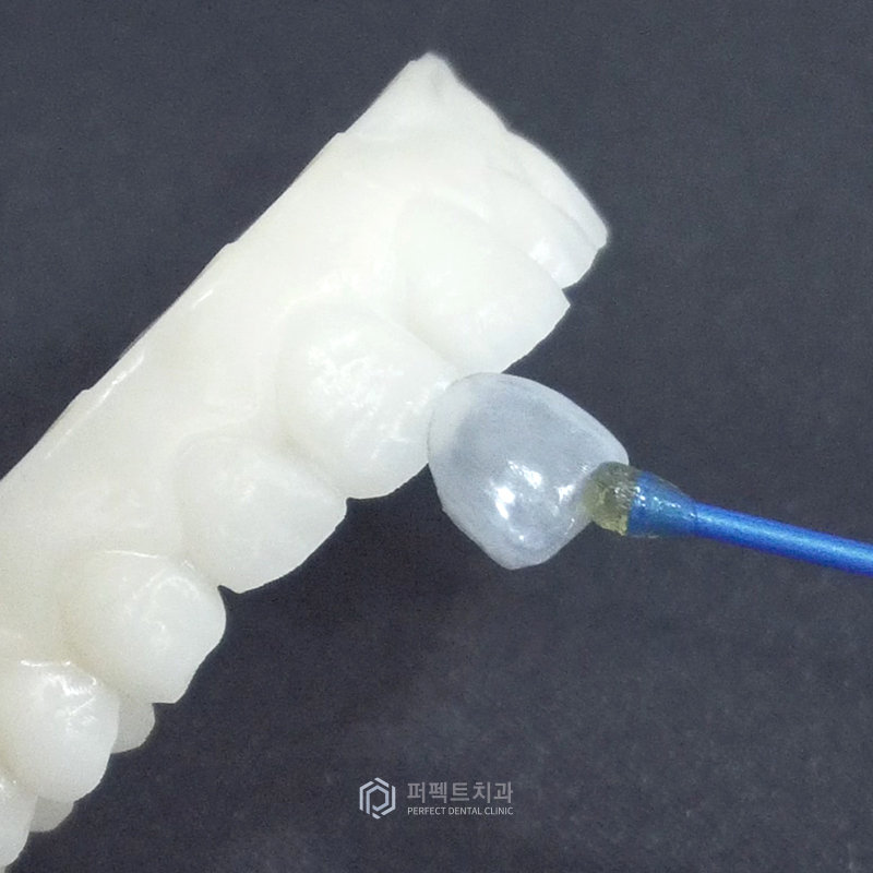 라미네이트 얇을수록 좋은가요? 관련 이미지 3