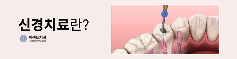 신경치료 아프지 않을까? 관련 이미지 2