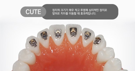 고민되는 부분만 집중적으로 부분교정 하자! 관련 이미지 4