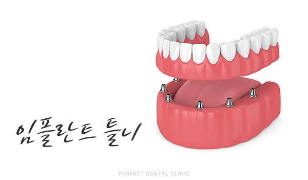 상실한 치아 어떻게 해야하나? 관련 이미지 6