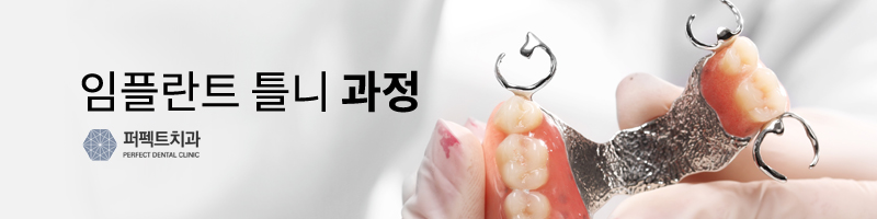 임플란트틀니 뭐가 다른가요? 관련 이미지 3