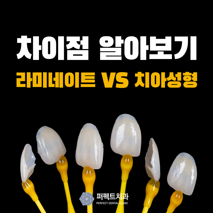라미네이트와 치아성형 큰 차이점 관련 이미지 1