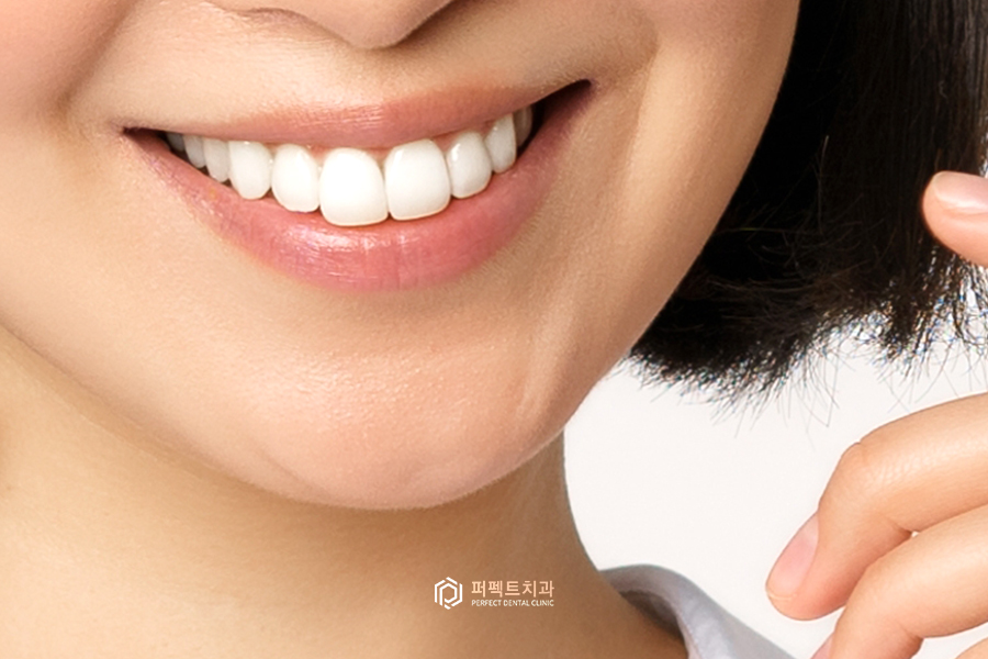 치아미백｜통증, 주기, 주의사항 관련 이미지 5