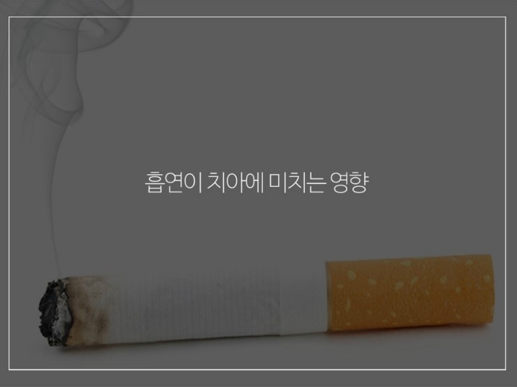 흡연이 치아에 미치는 영향 알아보기 관련 이미지 1