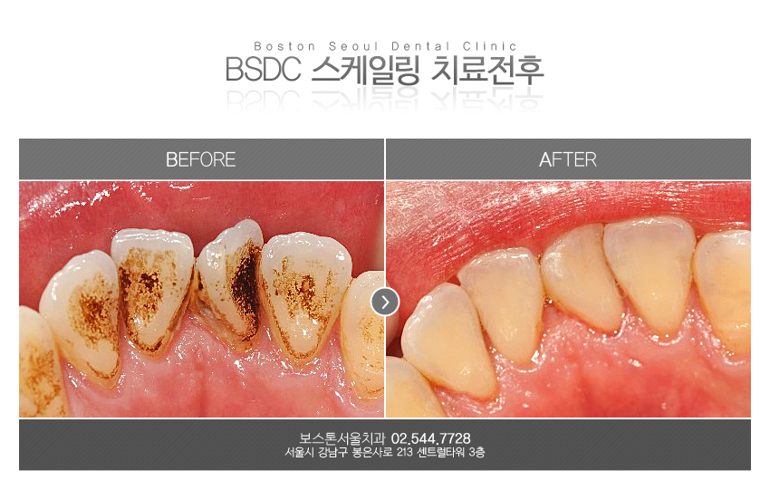 스케일링의 긍정적인 효과들 관련 이미지 2